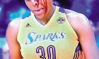 跳水失败脸摔两半图 跳水失败脸摔两半图